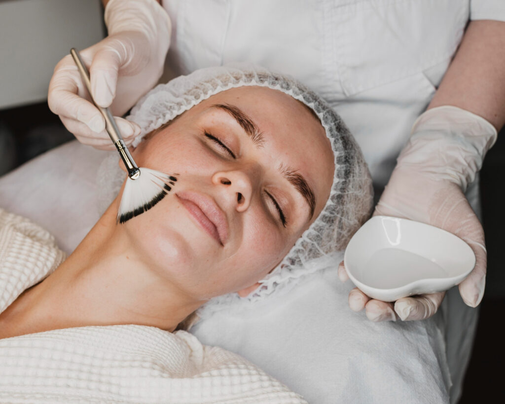 Chemical Peel Treatment