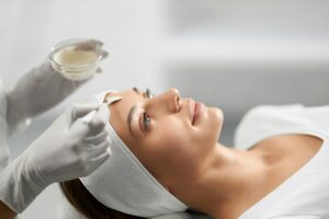 Facial Chemical Peel