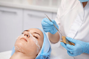 chemical peels