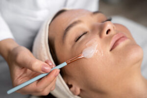 chemical peel treatment